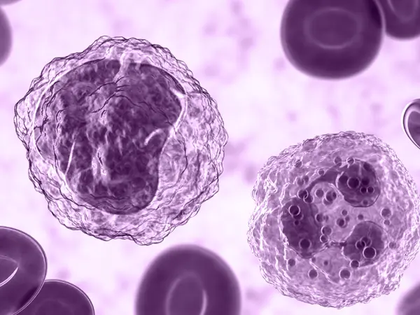 Myelodysplastic syndromes